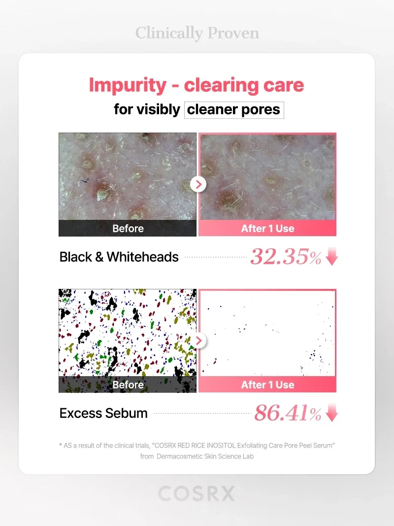 COSRX RED RICE INOSITOL Exfoliating Care Pore Wash-Off Peel Serum product view