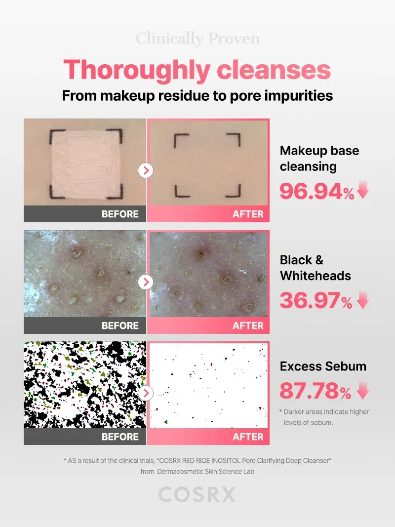 COSRX RED RICE INOSITOL Pore Clarifying Deep Cleanser product view