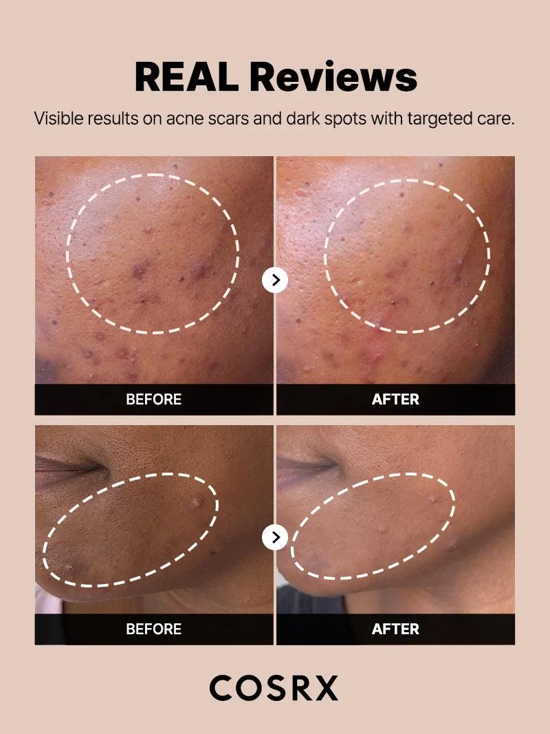 The Alpha-Arbutin 2 Discoloration Care Serum product view